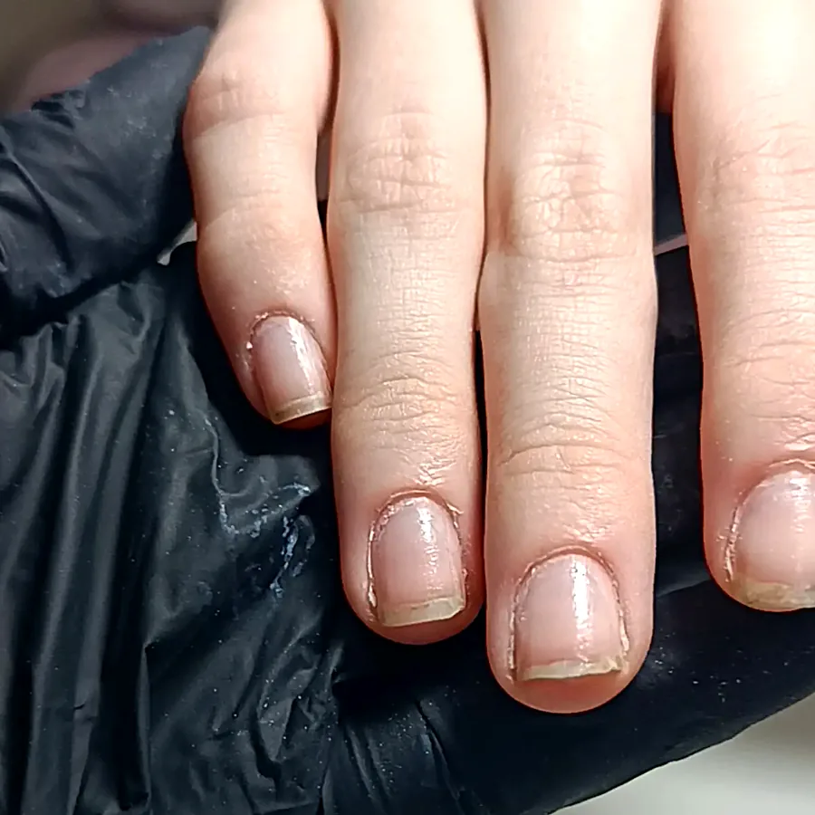 Antes: unhas naturais curtas, sem esmaltação